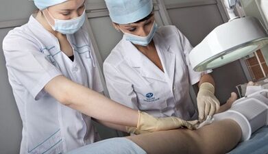 Tratamento cirúrxico de varices