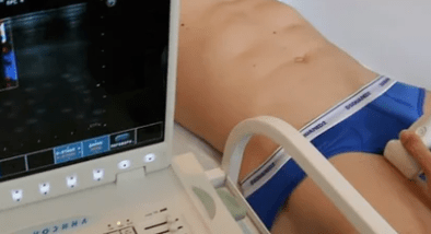 Opcións de diagnóstico para varices das extremidades inferiores