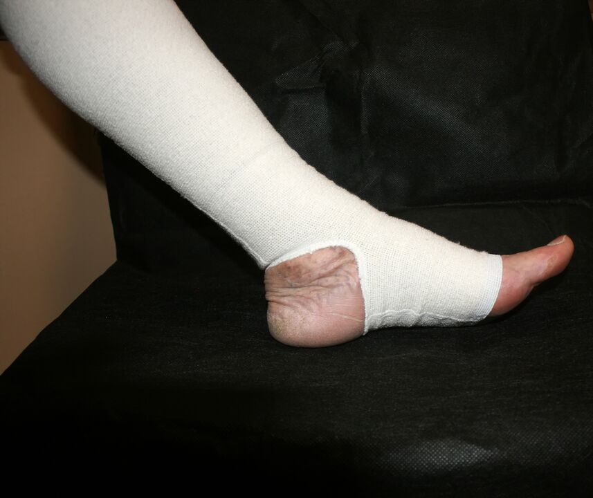 Imprimir roupa de tricô para varices